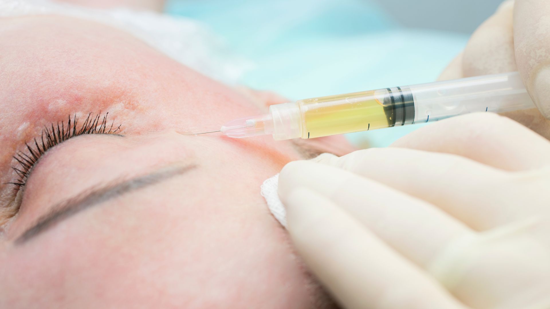 How Are Peptide Injections Promoting Youthful Skin?
