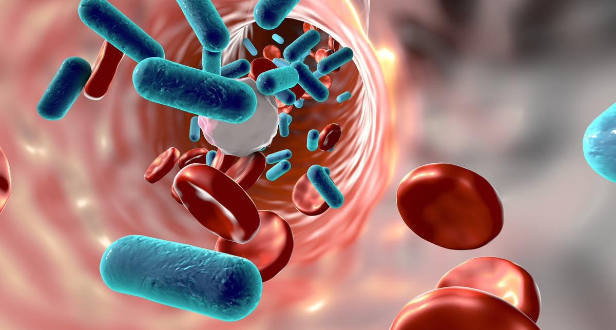 Gezielte Immuntherapie kann Organversagen vermeiden – News – Deutsches Ärzteblatt